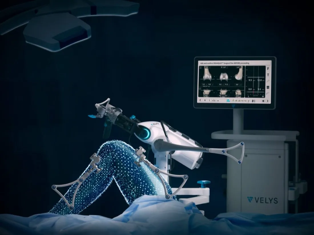 VELYS robotic-assisted knee replacement system in the operating theatre